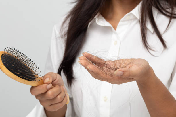 hair loss